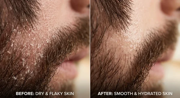 beard